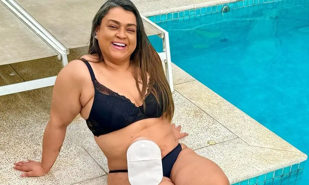 Preta Gil confirma cirurgia para retirar bolsa de ileostomia: ‘Cada vez mais perto do fim’