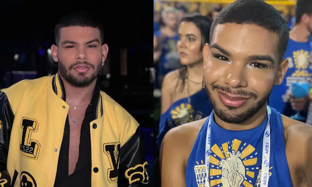 Vyni, do ‘BBB 22’, desabafa sobre procedimentos estéticos: ‘Minha cara era usada como chacota’