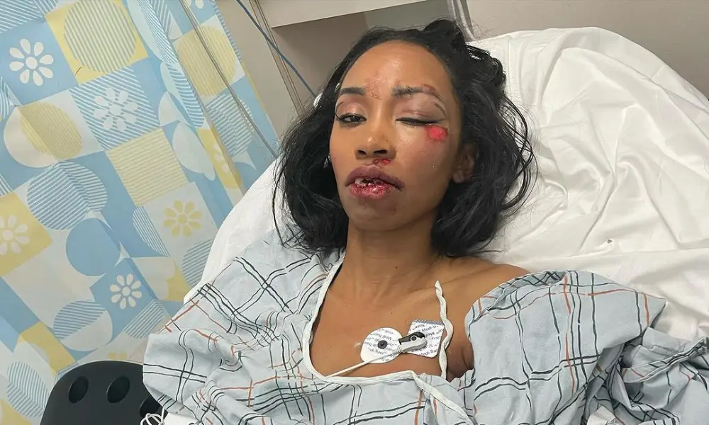 Atriz de ‘Pantera Negra’ e ‘Vingadores’ sofre grave acidente em Nova York – Headline News, edição das 21h