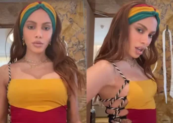 Anitta reaparece após procedimento estético e web comenta nova aparência: ‘outra pessoa’