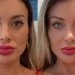 Andressa Urach relata dor após cirurgia para mudar cor dos olhos: ‘Estou arrependida de ter feito’