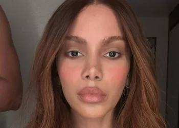 Anitta fala pela primeira vez sobre novos procedimentos estéticos: ‘O corpo é meu’