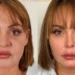 Gaby Spanic, de Usurpadora, surge irreconhecível após harmonização facial