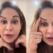 Maíra Cardi exibe rosto deformado após botox dar errado: ‘Olha que palhaçada’